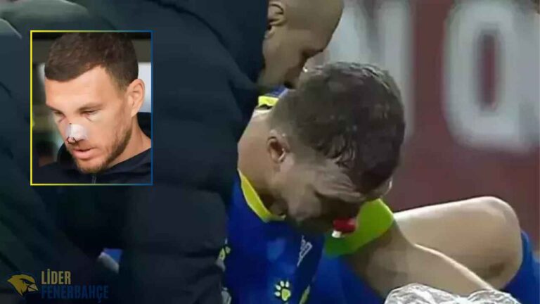 Dzeko'nun Burnunda Kırık, İstanbul'a Dönüyor